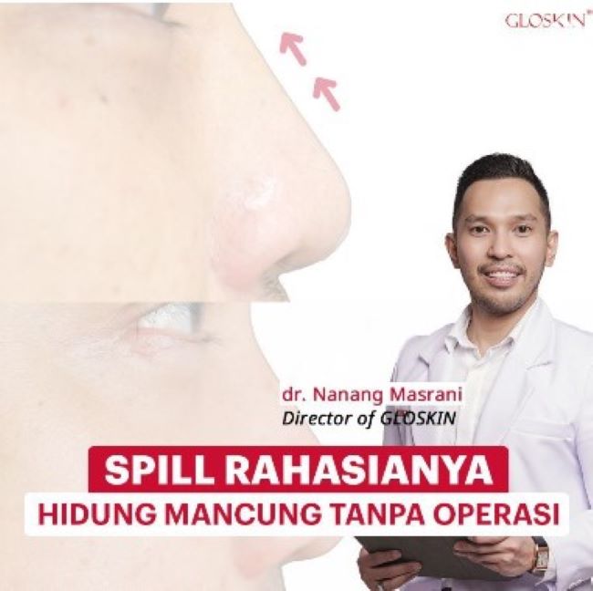 dr. Nanang Masrani Dokter Kulit Banjarmasin - Photo by Gloskin Instagram